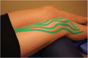 medical taping