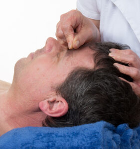 acupunctuur